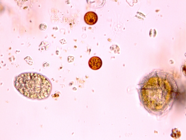 lepocinclis